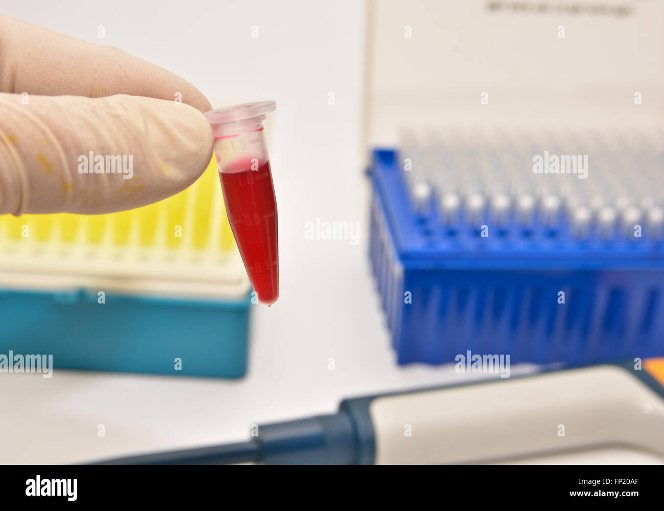 Das Rohr des Blutes. Das Studium des menschlichen Blutes in medizinischen Laboratorien. Stockfoto