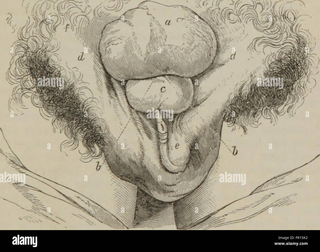 Diese Illustration aus dem Jahr 1853 zeigt die Praxis der Chirurgie Mitte des 19. Jahrhunderts und spiegelt die medizinischen Techniken und Instrumente dieser Zeit wider. Das Bild gibt einen Einblick in die medizinischen Fortschritte der Epoche und zeigt die frühen Stadien der modernen Chirurgie. Stockfoto