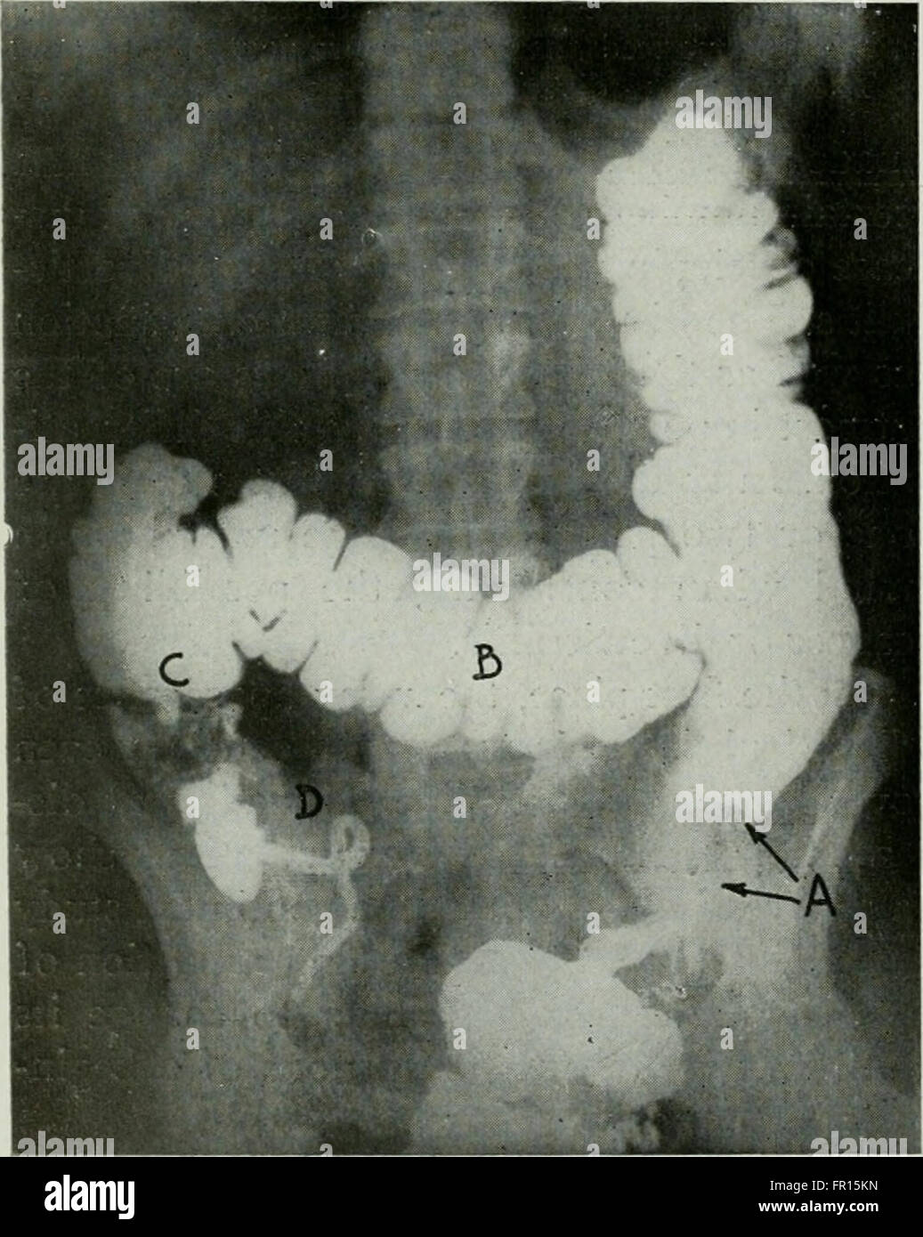 American Journal of Roentgenology, Radium-Therapie und Nuklearmedizin (1906) Stockfoto