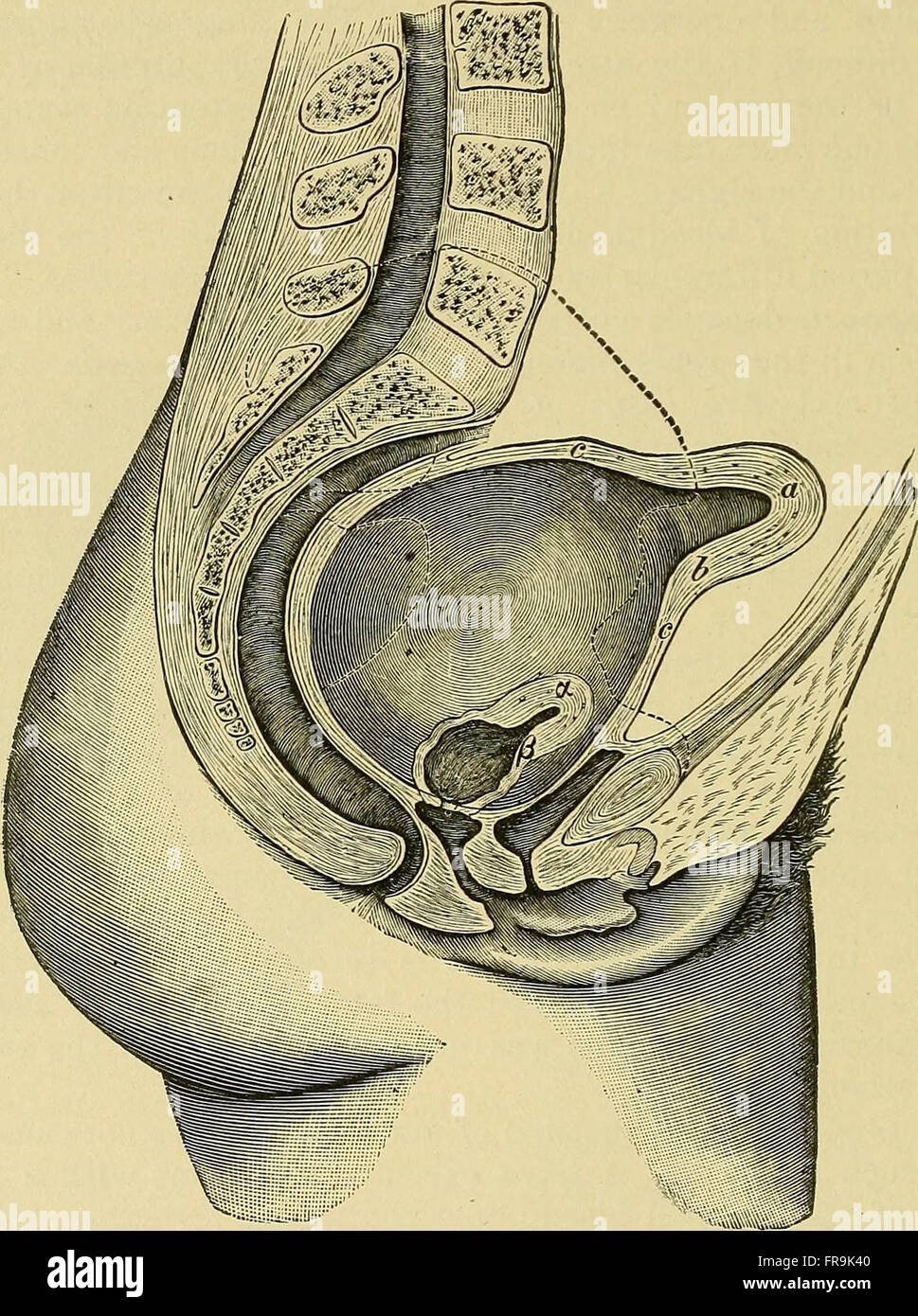 Pathologie und Behandlung von Erkrankungen bei Frauen (1912) Stockfoto
