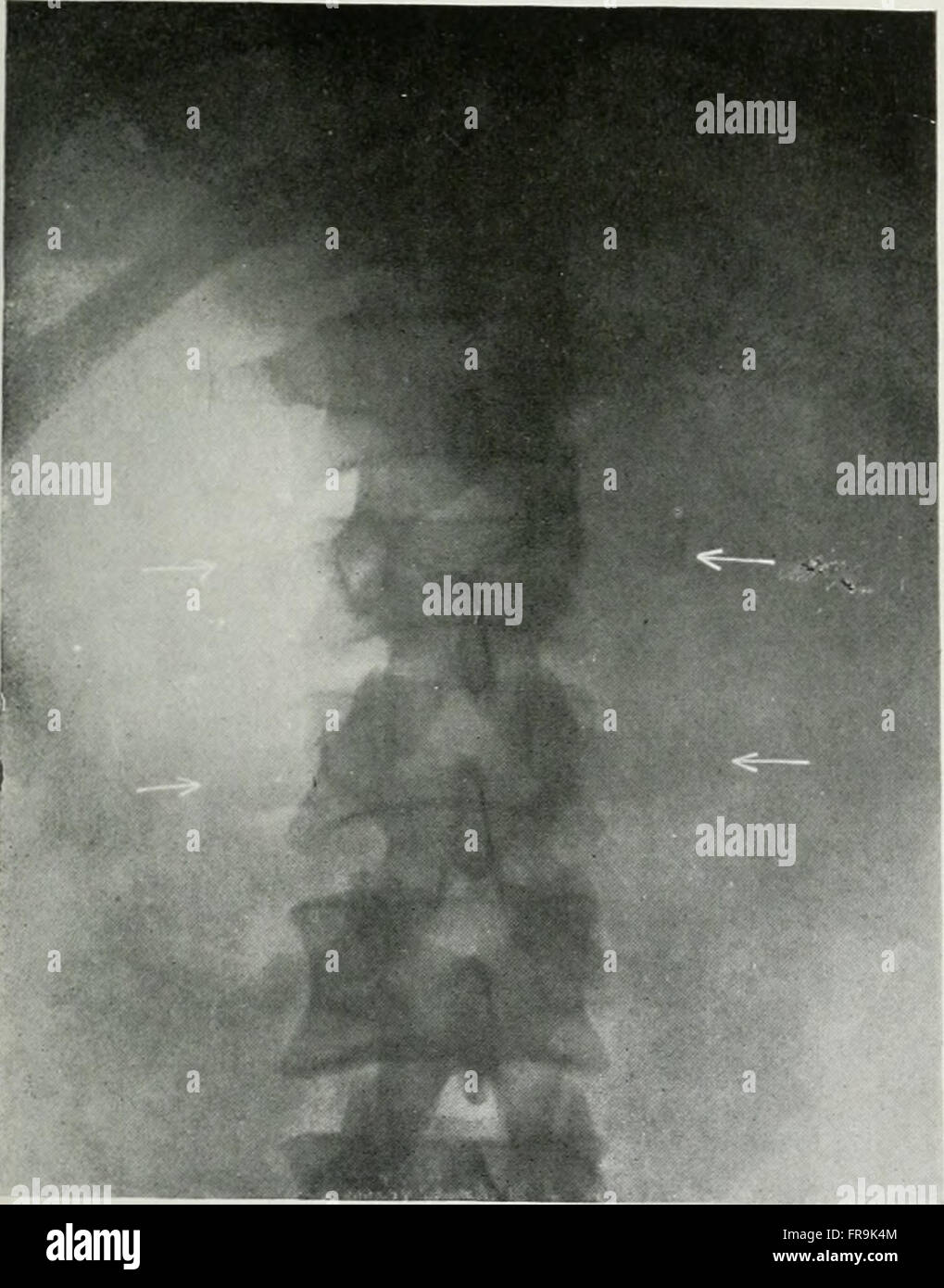 American Journal of Roentgenology, Radium-Therapie und Nuklearmedizin (1906) Stockfoto
