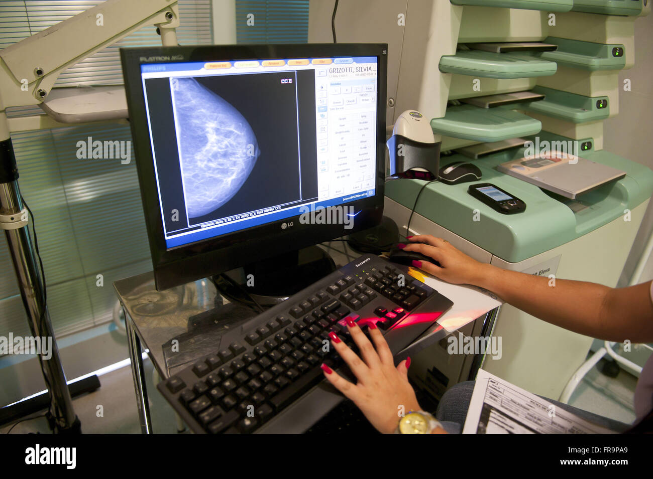 Mammographie in Wagen machen Prüfungen notleidende Bevölkerung getan Stockfoto
