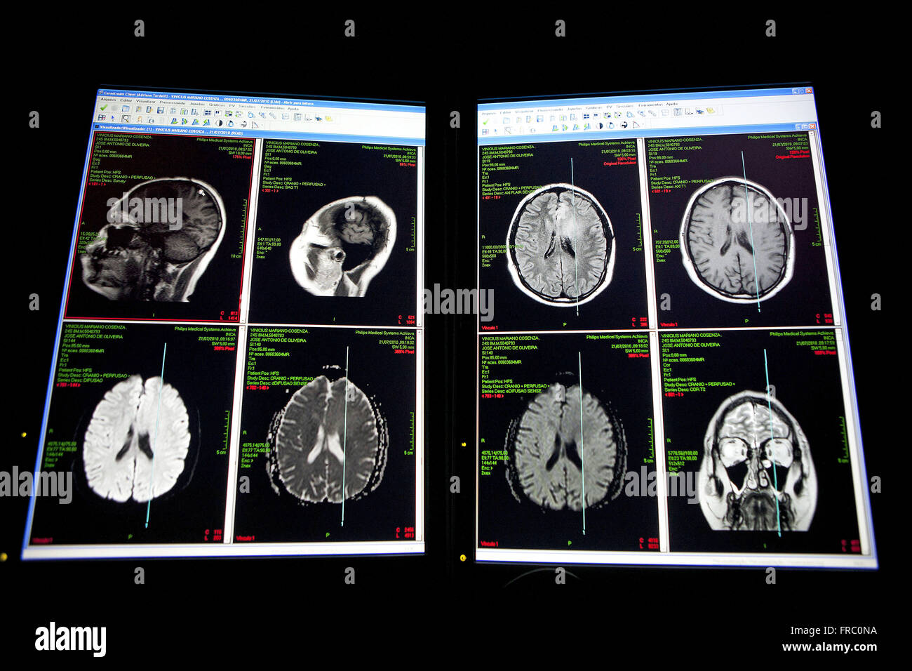 MRI - INCA - National Cancer Institute Stockfoto