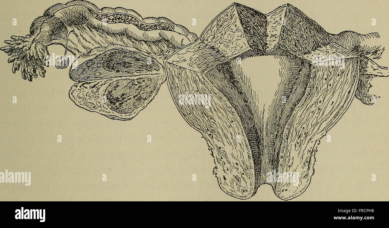Postmortem pathology manual technic post mortem Fotos und