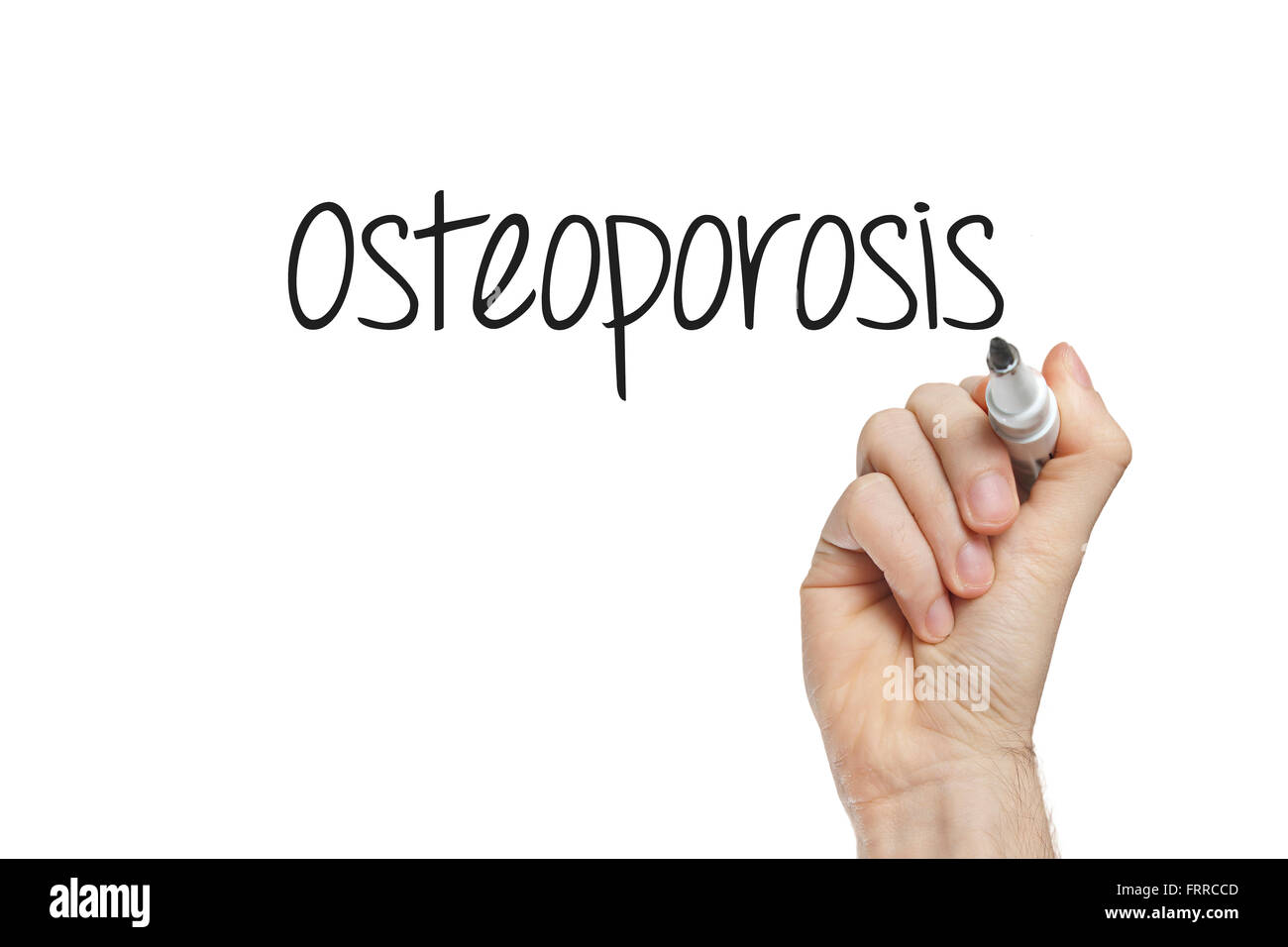 Handschrift Osteoporose auf eine weiße Tafel Stockfoto