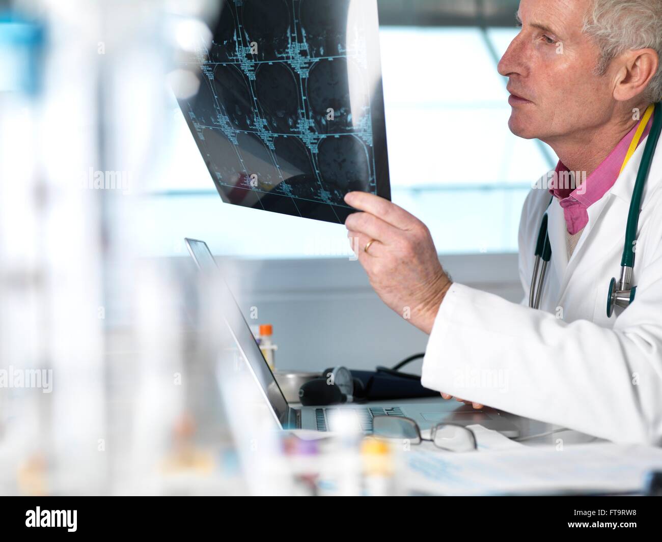 Eigentum freigegeben Modell veröffentlicht Arzt studiert Film Blatt berechnet Computertomographie (CT) scannt verschiedene Abschnitte durch die Stockfoto