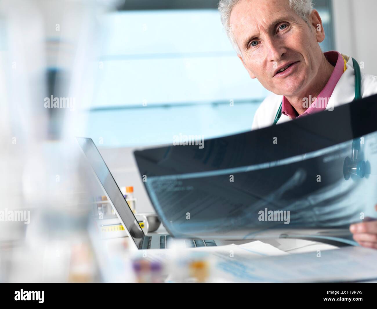 EIGENTUM FREIGEGEBEN. -MODELL VERÖFFENTLICHT. Arzt eine Röntgenaufnahme einer gebrochenen Hand in einem Krankenhaus anzeigen. Stockfoto