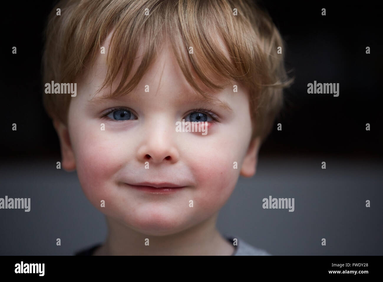 Eine externe Gerstenkorn oder Gerstenkorn Hordeolum, ist auch eine Infektion der Talgdrüsen der Zeis an der Basis der Wimpern oder eine Infe Stockfoto