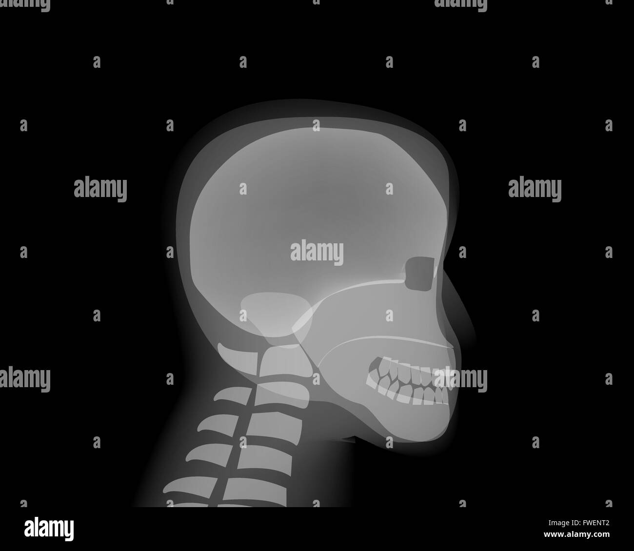 Der Seite Ansicht menschlichen Kopf Schädel auf Röntgenfilm, Vektor Stock Vektor