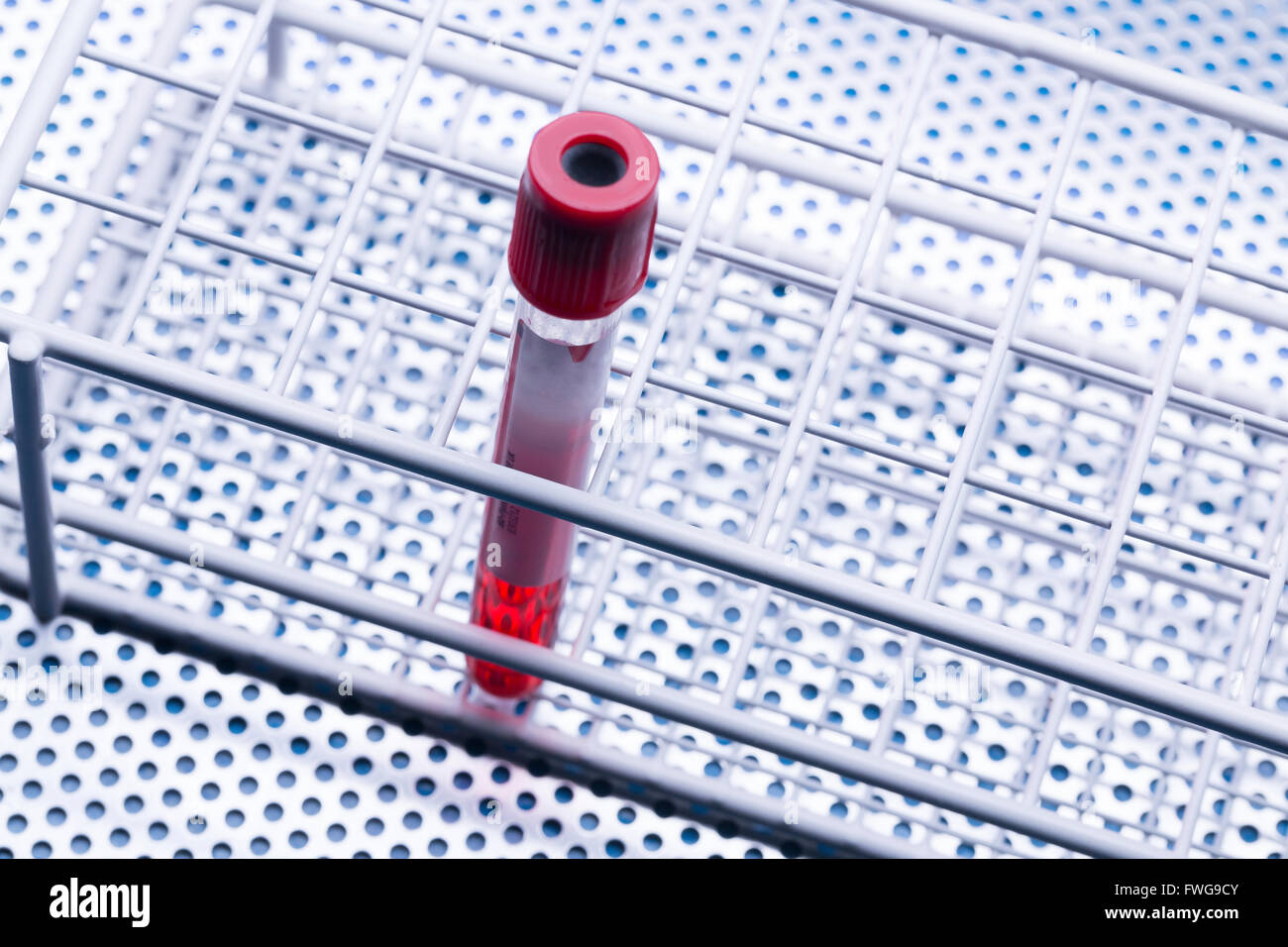 VacutainerRöhrchen mit Blut abnehmen Stockfotografie Alamy