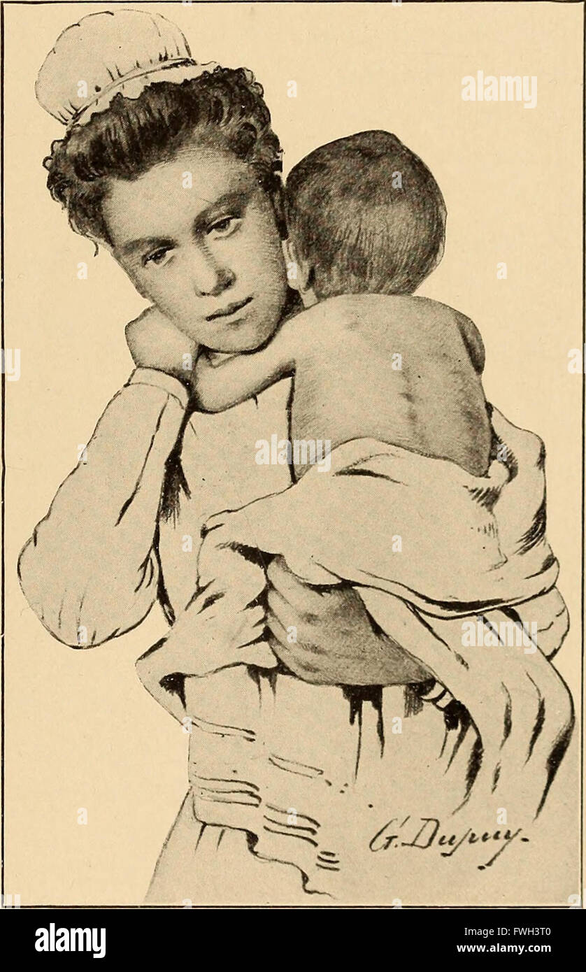 Dieser Text aus dem Jahr 1910 befasst sich mit den Krankheiten und Gesundheitszuständen von Säuglingen und Kindern und enthält detaillierte Beschreibungen der häufigsten Krankheiten, Diagnosemethoden und Behandlungen während des frühen 20. Jahrhunderts. Stockfoto