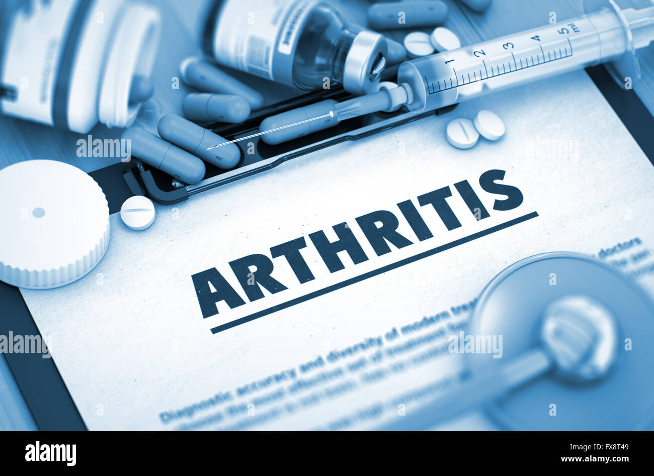 Arthritis. Medizinisches Konzept. Stockfoto