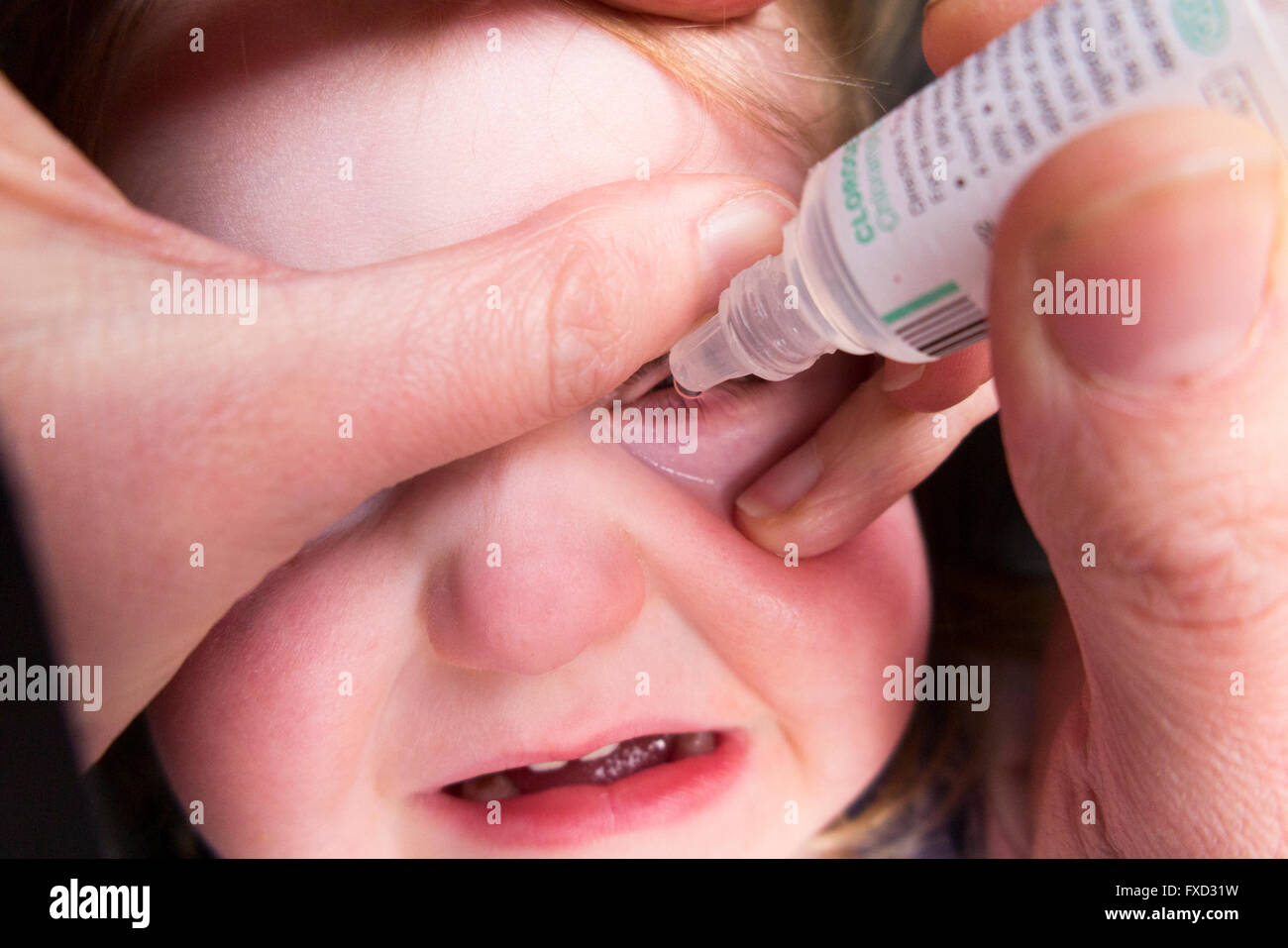 20 Monate altes Kind / Kind Kleinkind Baby mit Bindehautentzündung  antibiotische Augentropfen Tropfen von ihrer Mutter gegeben werden / Mutter  Stockfotografie - Alamy