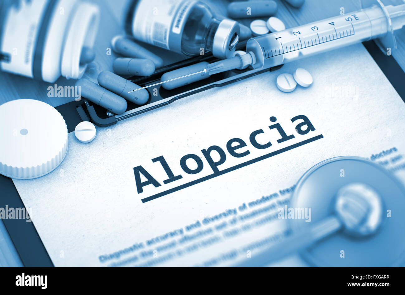 Alopezie-Diagnose. Medizinisches Konzept. 3D Render. Stockfoto