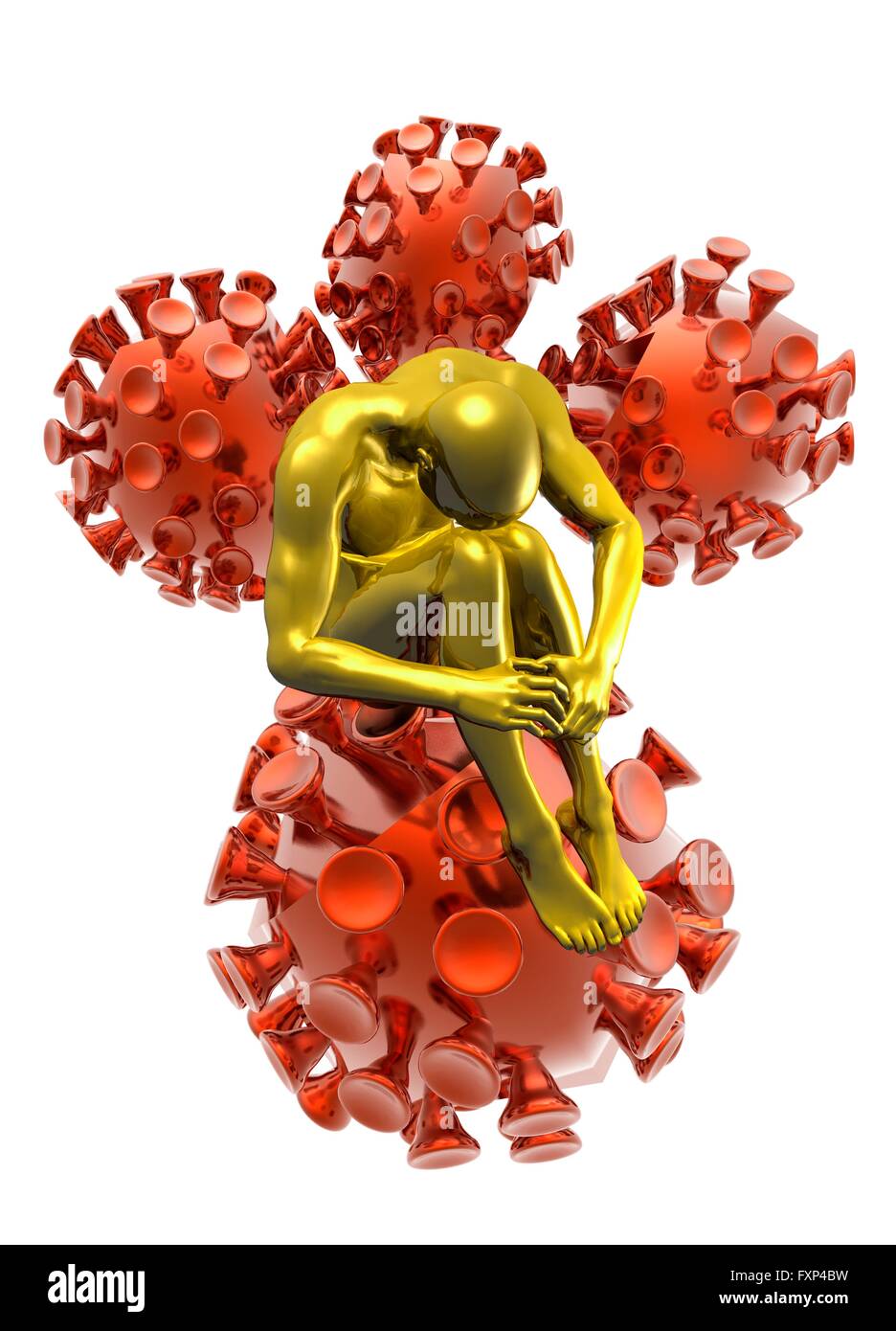 Person mit Aids (Acquired Immune Deficiency Syndrom), konzeptionelle Darstellung. Stockfoto