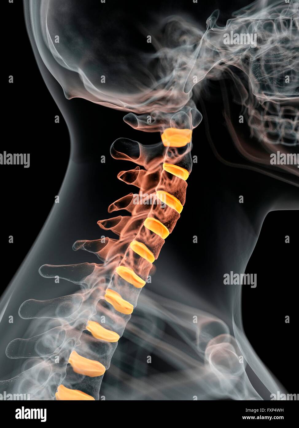Menschlichen Bandscheiben des Halses, Computer Bild. Stockfoto