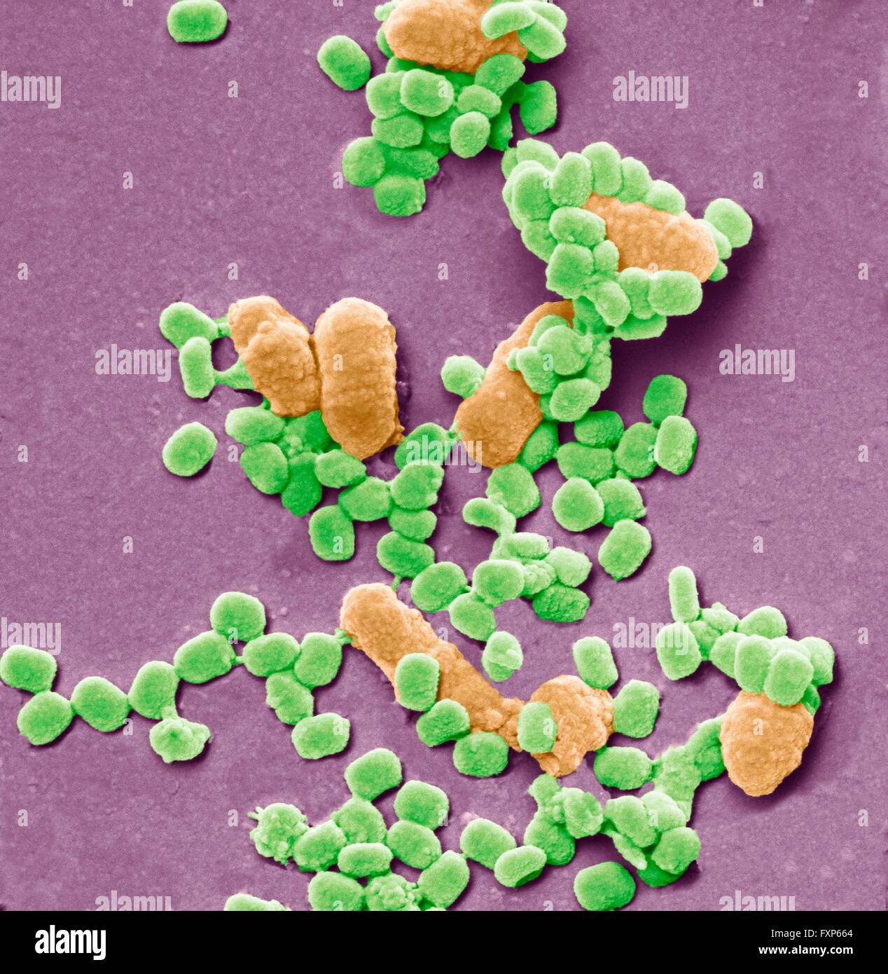 Vaccinia-Virus-Partikel und Bakterien. Farbige scanning Electron Schliffbild (SEM) der Vaccinia-Virus-Partikel (grün). Im Gegensatz zu den meisten Viren repliziert "Vaccinia" in der Zelle Zytoplasma, anstatt den Kern. "Vaccinia" gehört zu den Orthopoxviren. Es bewirkt, dass Kuhpocken, eine Krankheit von Vieh und Mensch, dass produziert Hautläsionen. Es wurde zuerst von Jenner 1796 verwendet, gegen die Pocken, eine Verwandte aber mehr tödliche Krankheiten zu impfen. Es gibt etwa zehnmal so viele Bakterienzellen in der menschlichen Flora gibt es menschliche Zellen im Körper, mit der größten Zahl der menschlichen flora Stockfoto