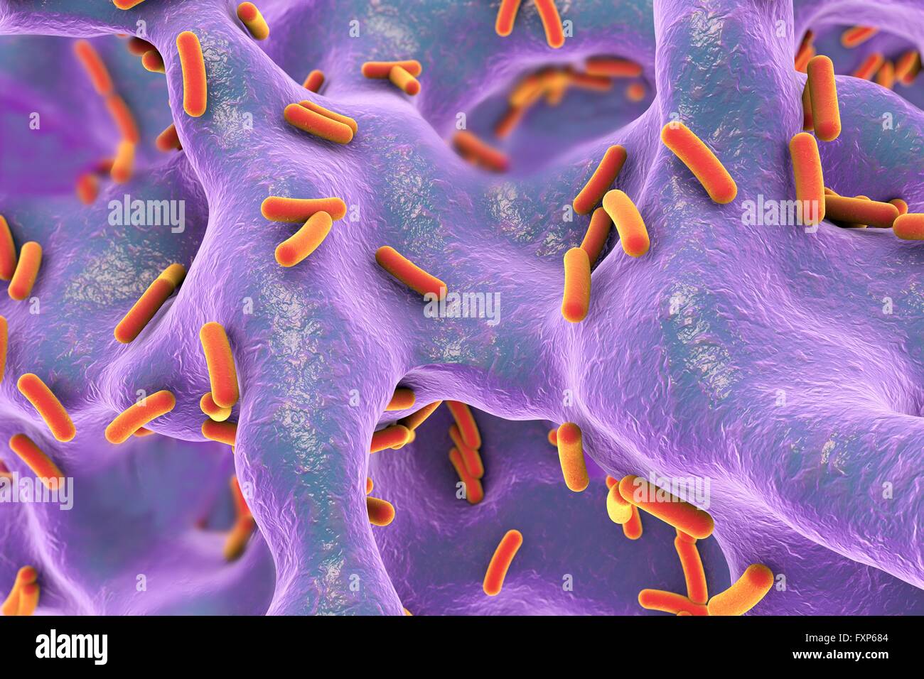 Pseudomonas Aeruginosa Bakterien infiziert Knochen (Osteomyelitis), Computer-Abbildung. Osteomyelitis ist eine Infektion der Knochen oder Knochenmark, oft durch multiresistente Bakterien einschließlich Pseudomonas Aeruginosa verursacht. Stockfoto