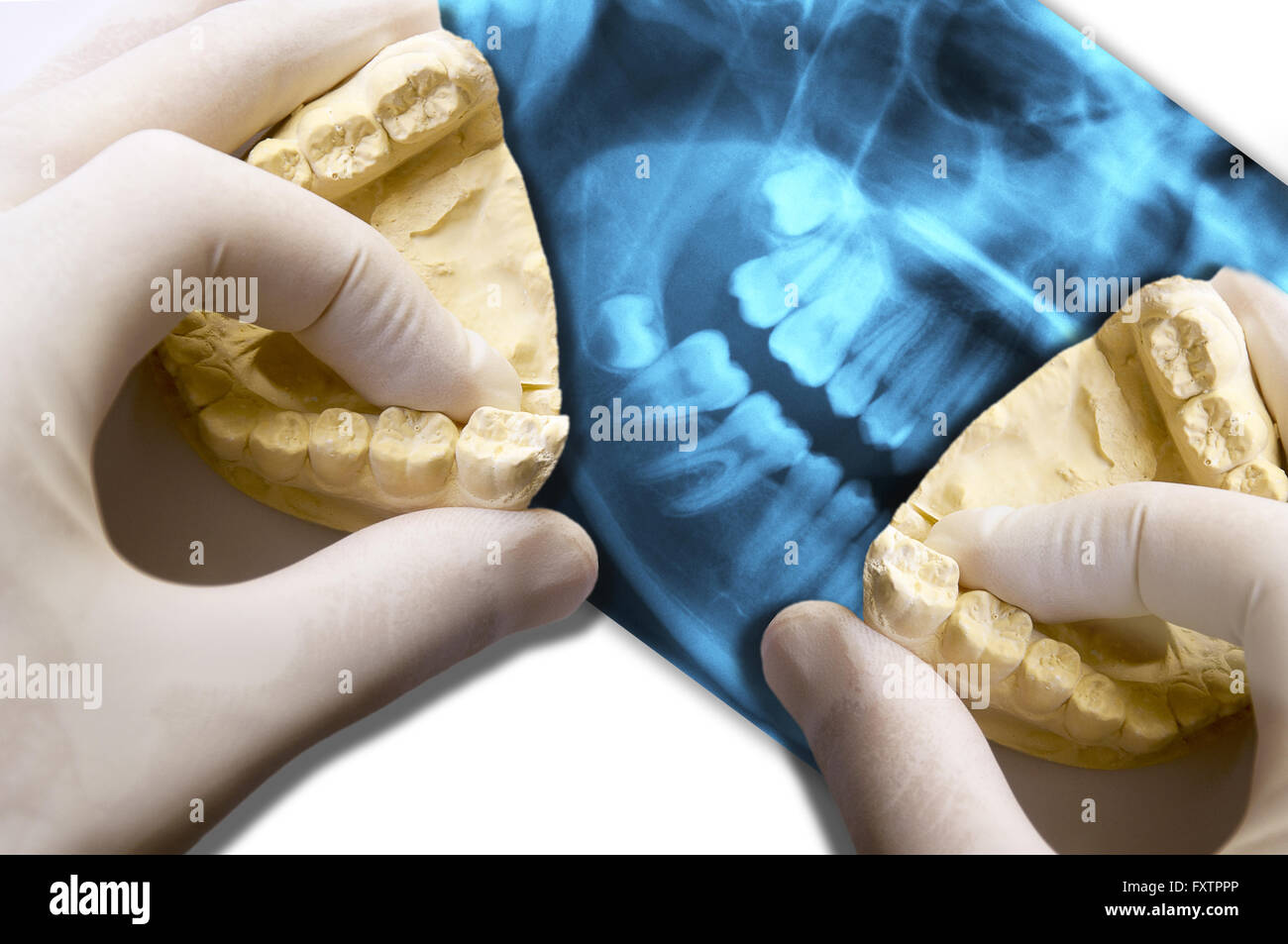 Zahnarzt Hände zeigen molare Zähne Modelle über dental-scan Stockfoto