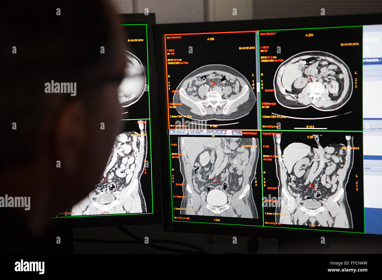 CT-SCAN-PRÜFUNG Stockfoto