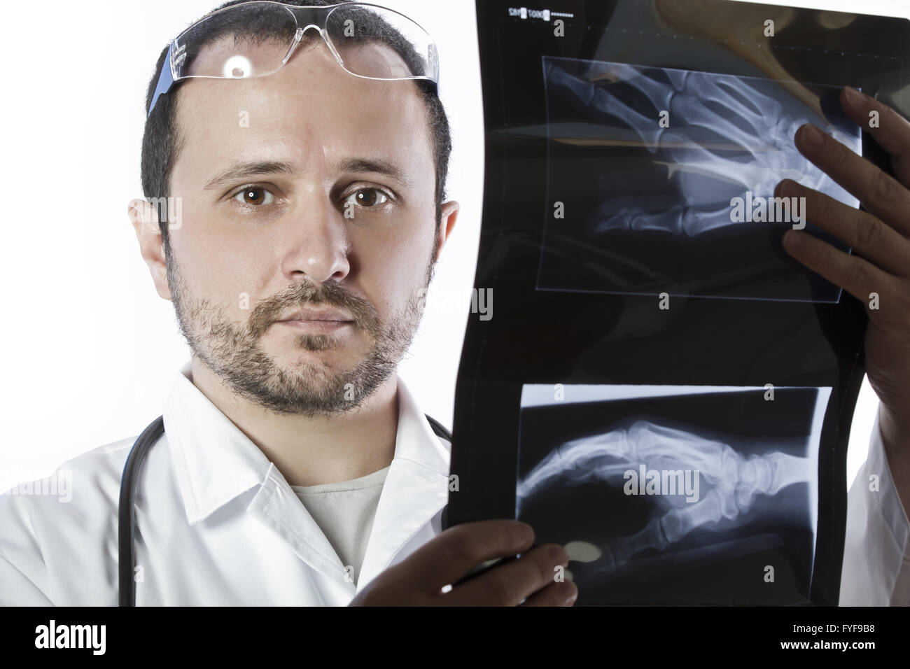 Arzt hält Rechtsmittel Röntgenaufnahme einer Hand Stockfoto