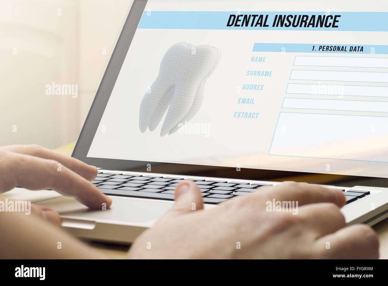 Gesundheit-Schutzkonzept: Mann mit einem Laptop mit Zahnversicherung auf dem Bildschirm. Die Bildschirmgrafik bestehen. Stockfoto