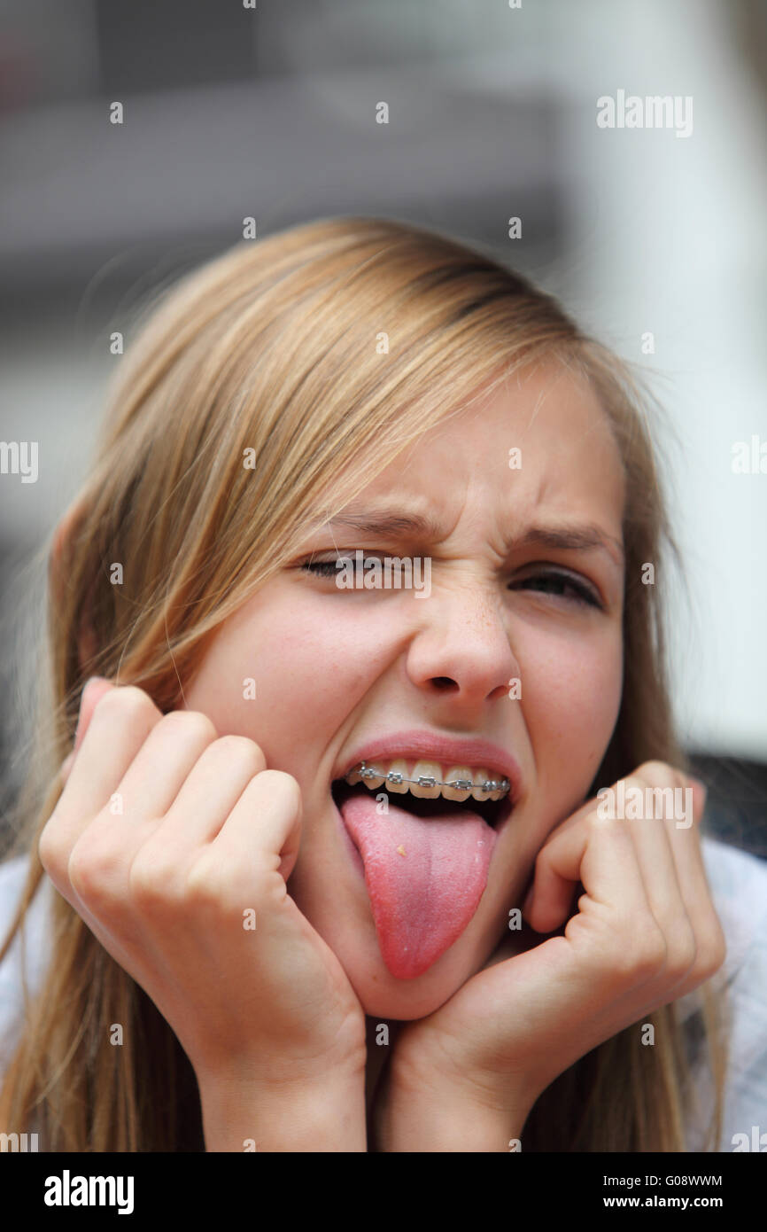Yong-Mädchen mit geschweiften Klammern ihre Zunge Stockfoto