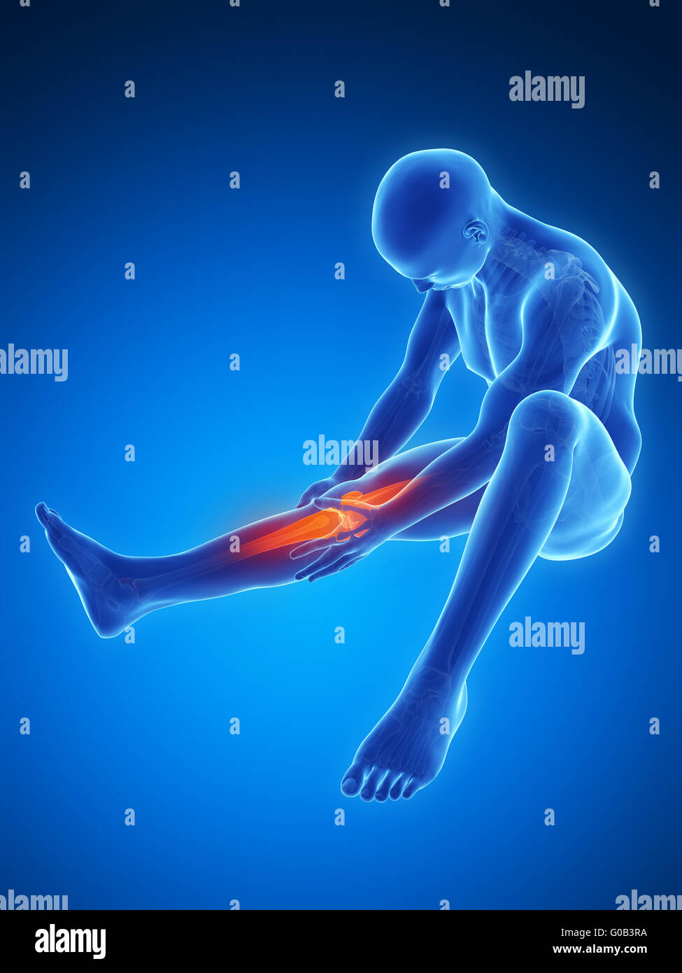 3D Gerenderte Darstellung Der Schmerzen Im Knie Stockfotografie - Alamy