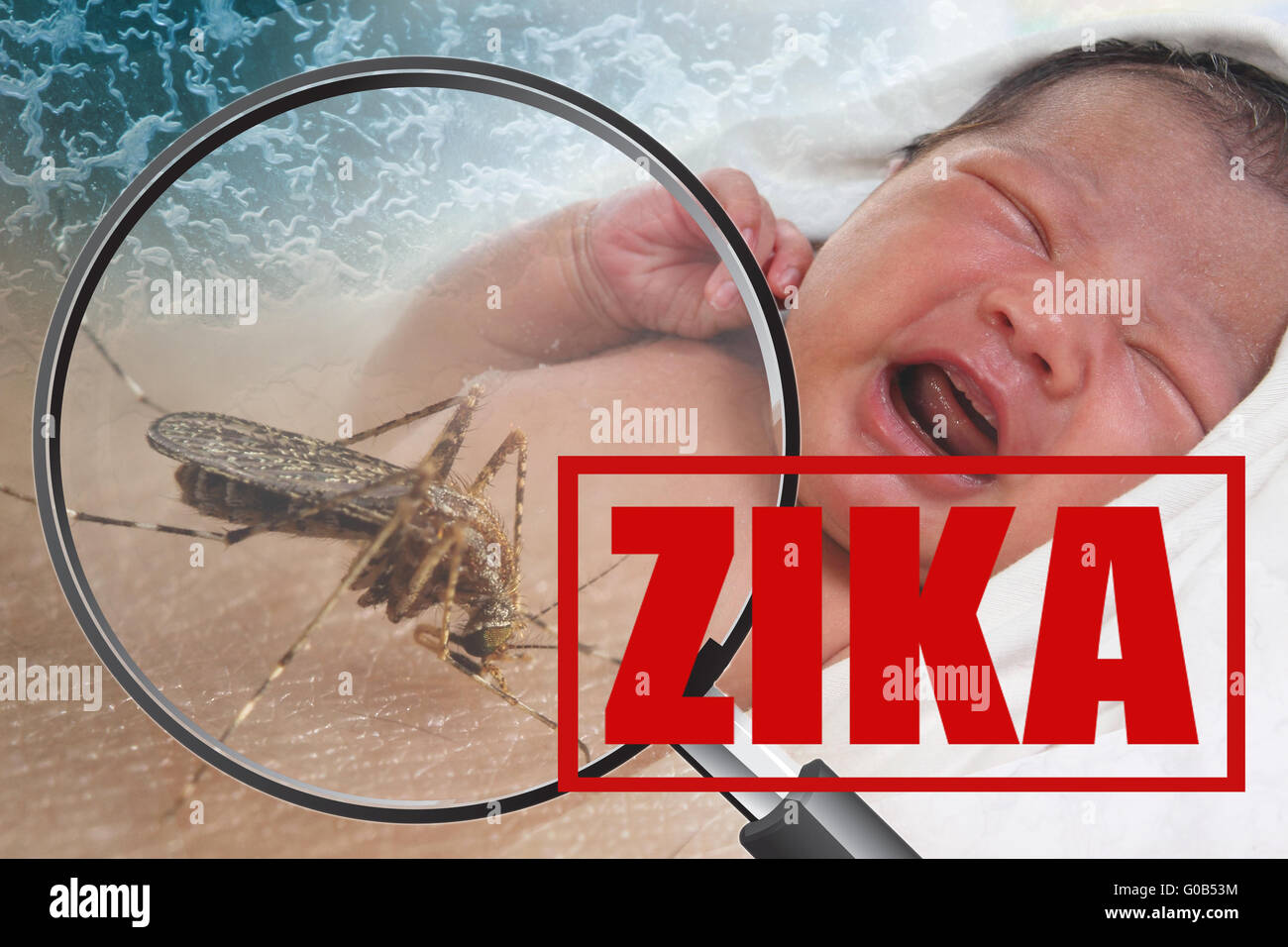 Konzept der Gesundheit Problem, Bild schreiendes Baby gebissen von Aedes Aegypti Mücke als Zika-Virus-Träger Stockfoto