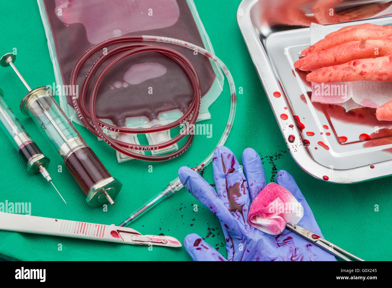 Einheit der Konzentration der roten Blutkörperchen, blutstillende Kocher Pinzette, Transplantation des oberen Extremität in einem OP-Raum Stockfoto