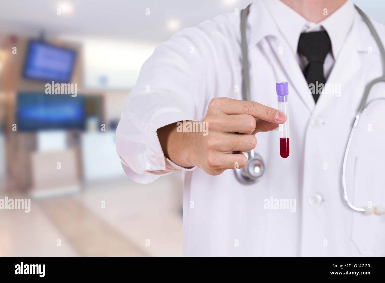 Schließen Sie sich einem medizinischen Test-Glas mit Blut mit Arzt Stockfoto