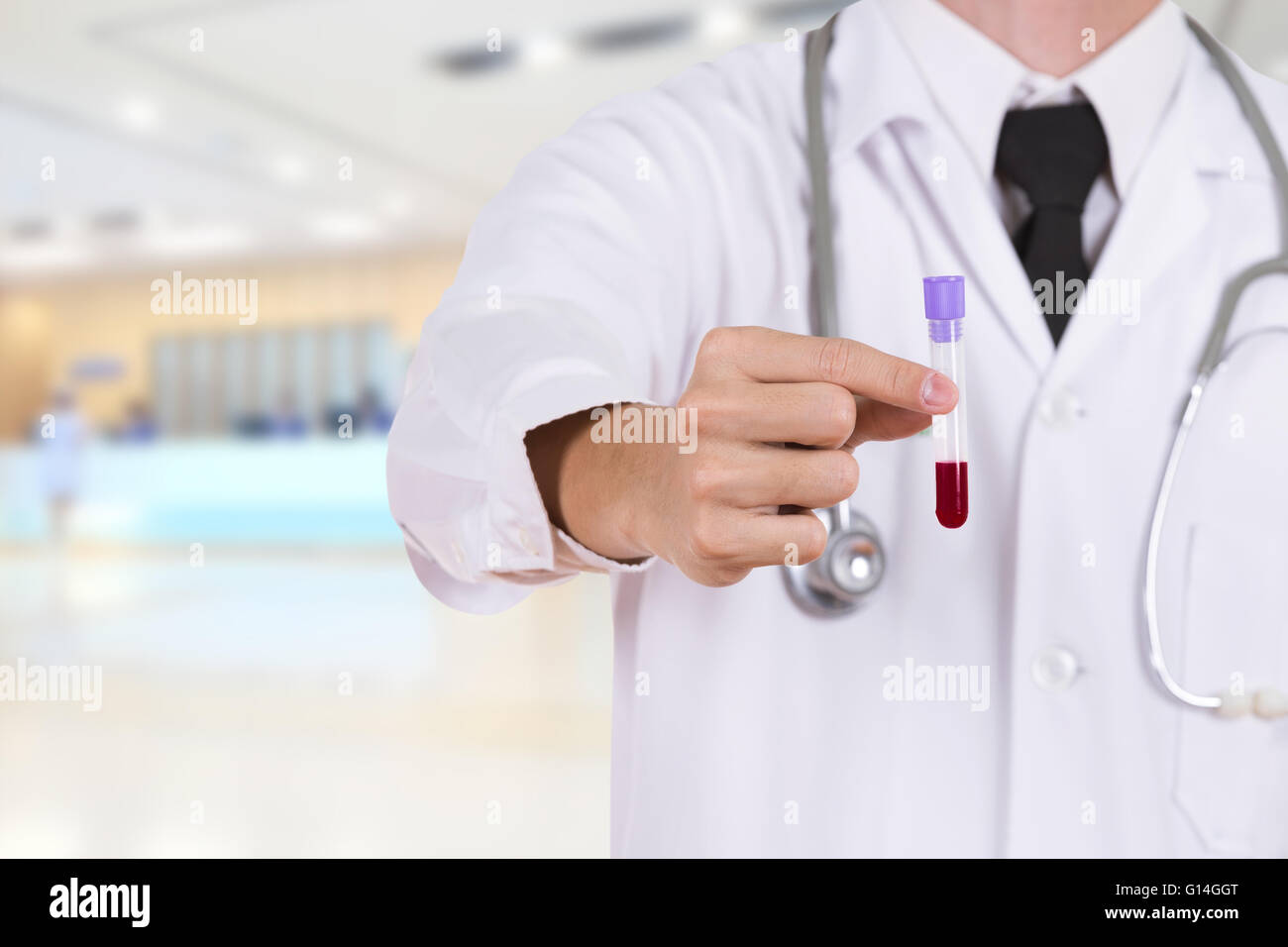 Schließen Sie sich einem medizinischen Test-Glas mit Blut mit Arzt Stockfoto