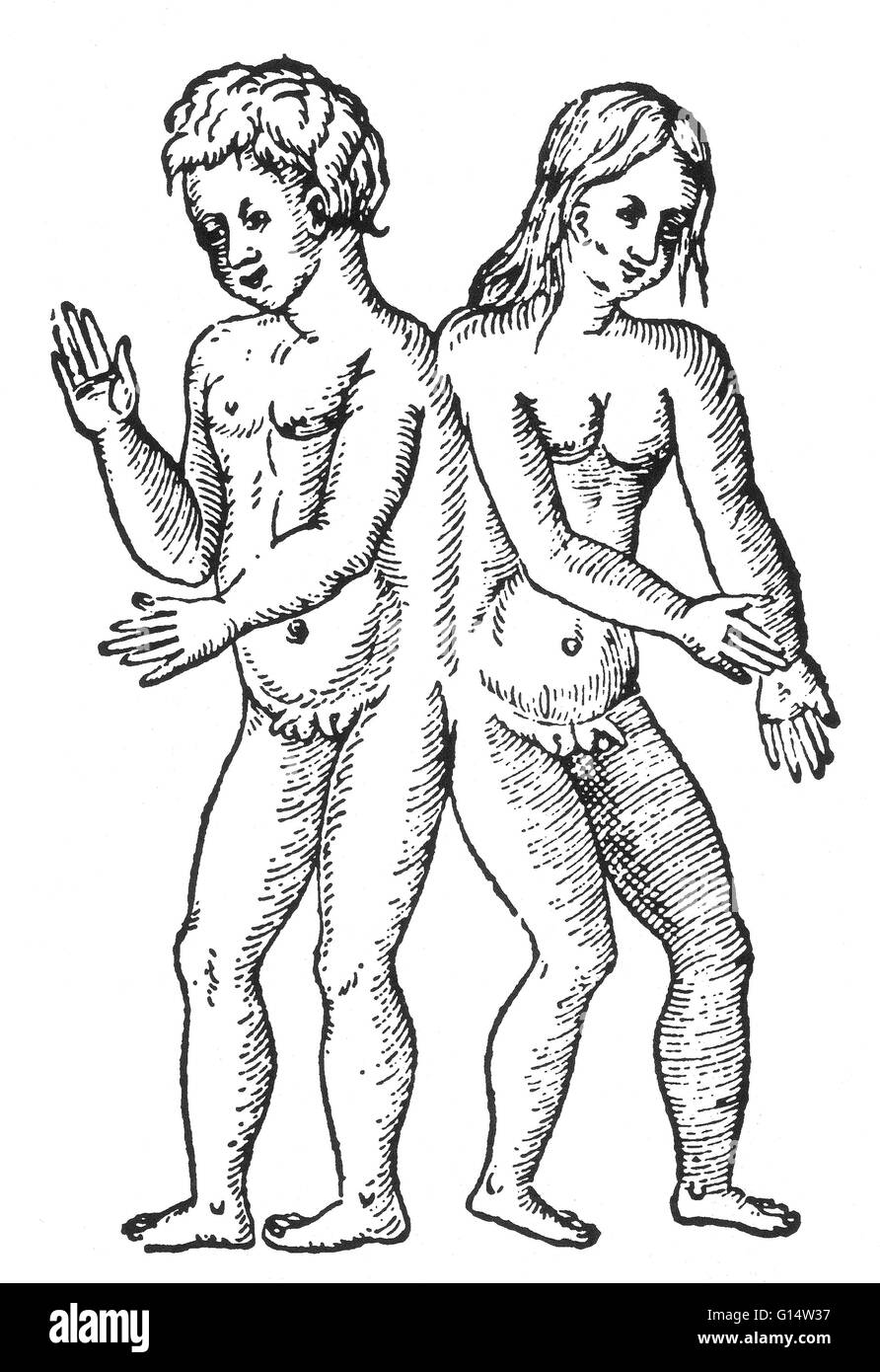 Holzschnitt "hermaphroditischen Zwillinge, verlötenden Rücken an Rücken" aus Des Monstres et Prodiges von Ambroise Paré, 1573. Siamesische Zwillinge sind eineiige Zwillinge geboren mit ihren Körpern trat zu einem bestimmten Zeitpunkt und mit unterschiedlichem Grad der restliche Doppelarbeit, ein Ergebnis Stockfoto