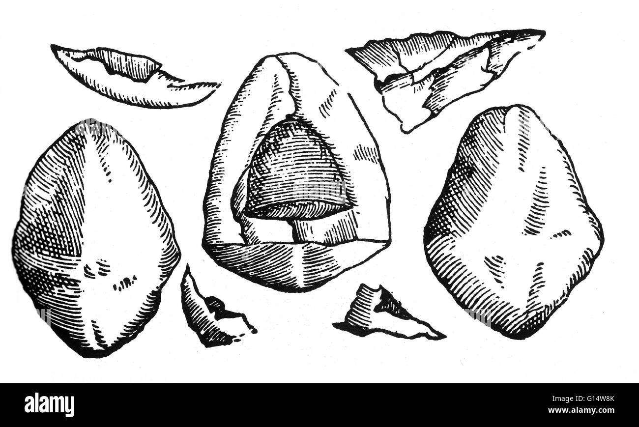 Holzschnitt "drei Steine extrahiert zur gleichen Zeit ohne ein Intervall aus der Blase eines Mannes namens Tire-Vit, eines davon gebrochen ist" aus Des Monstres et Prodiges von Ambroise Paré, 1573. Des Monstres ist gefüllt mit unbegründeten Konten des Meeres Stockfoto