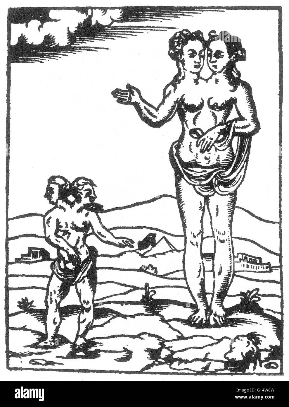 Holzschnitt von das "doppelte Monster Rhodiginus" und der Lycosthenes aus Des Monstres et Prodiges von Ambroise Paré, 1573. Siamesische Zwillinge sind eineiige Zwillinge mit ihrem Körper verbunden zu einem bestimmten Zeitpunkt und mit unterschiedlichem Grad der restliche Doppelarbeit geboren, Stockfoto