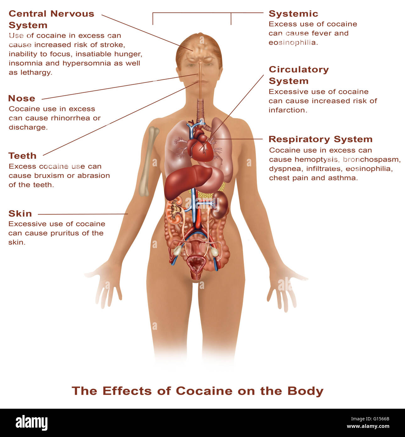 Abbildung der Frau, die die Effekte des Kokains verwenden, auf den Körper. Stockfoto