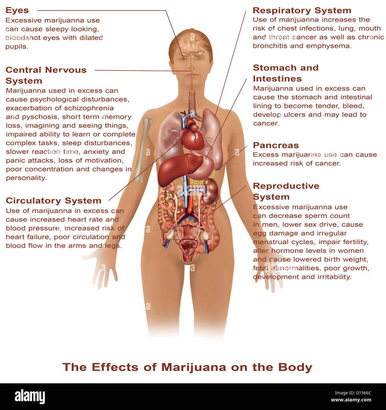 Abbildung der Frau, die die Auswirkungen von Marihuana verwenden, auf den Körper. Stockfoto