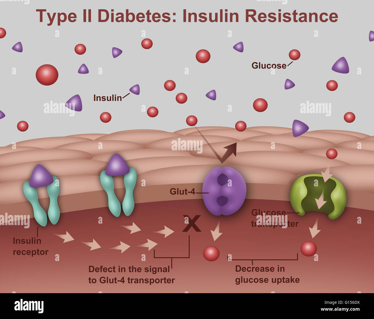 Llustration von Insulin und Glukose-Produktion bei Typ2 Diabetes. Insulin  (lila Dreiecke) wird von Inselzellen in der Bauchspeicheldrüse produziert  und handelt im Einklang mit Glukose (rote Punkte), Energie in den Zellen  des Körpers