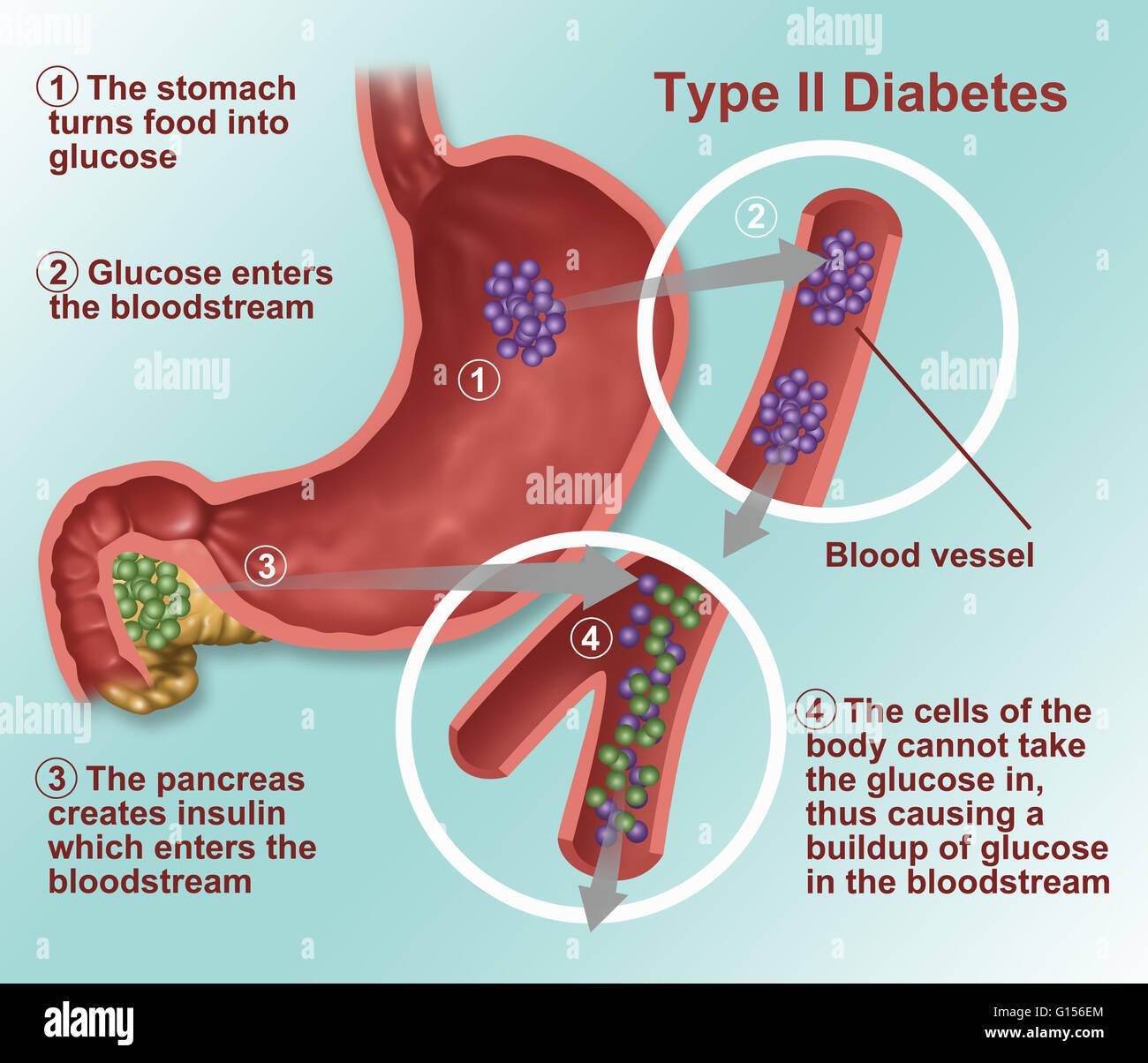 Llustration von Insulin und GlukoseProduktion bei Typ2 Diabetes. Insulin wird von Inselzellen Llustration von Insulin und GlukoseProduktion bei Typ2 Diabetes. Insulin wird von Inselzellen