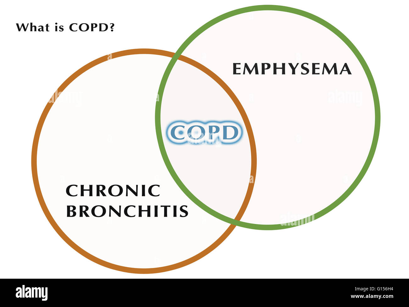 Das Diagramm zeigt die Beziehung zwischen chronischer Bronchitis
