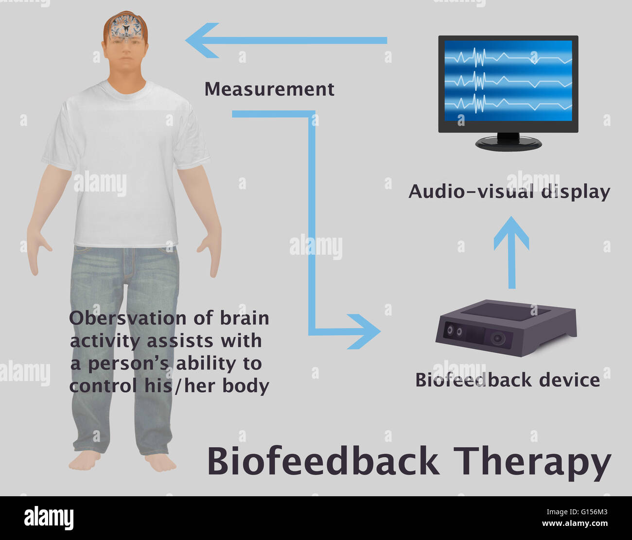 Eine Abbildung-Diagramm des Feedback-Schleife zwischen Person, Sensor (Biofeedback-Gerät) und Prozessor (Audio-visuelle Anzeige) dazu beitragen, Biofeedback-Training. Biofeedback ist manchmal zur Verbesserung der Gesundheit, Leistungsfähigkeit und die physiologische Veränderung Stockfoto