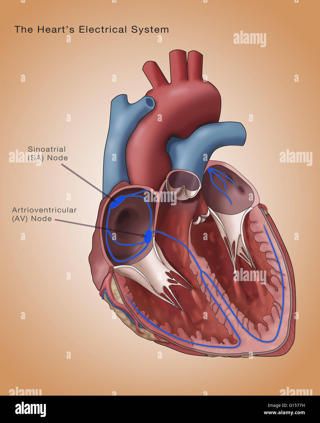 Abbildung zeigt das Herz Elektrik. Der Sinusknoten und Atrioventricular Knoten sind kommentiert. Der sinoatrial (SA)-Knoten (dicken lila Oval oben links) besteht aus self-excitatory Muskelzellen, die rhythmisch auf rund 70 Vertrag Stockfoto