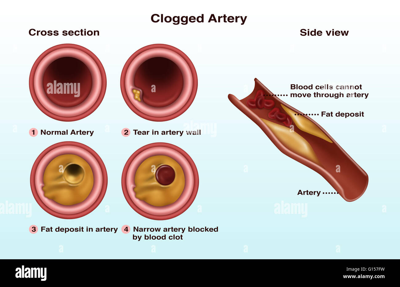 Die Arterien Und Ein Querschnitt Des Herzens Stockfotos Und Bilder Kaufen Alamy