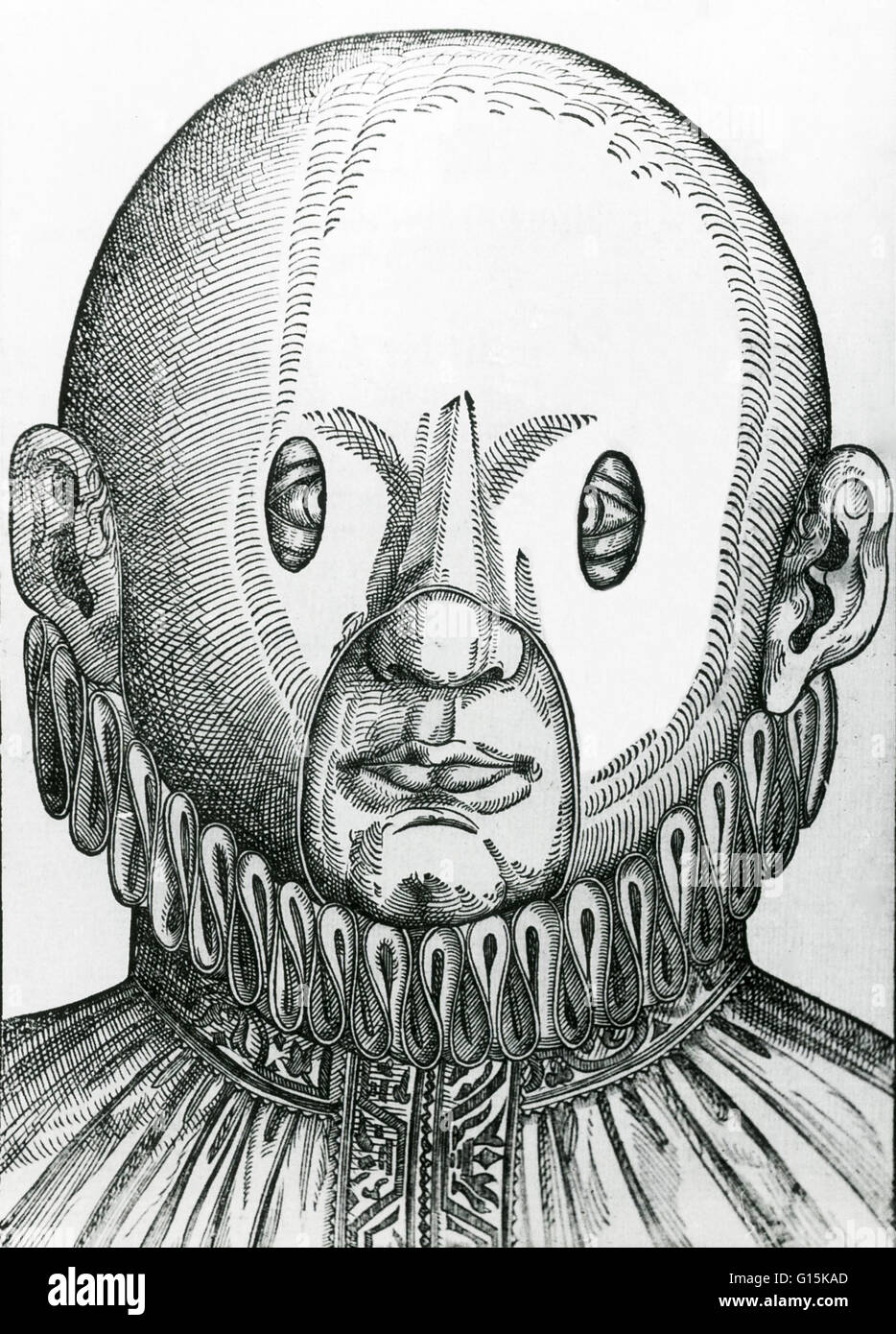 Eine Maske für die Korrektur gekreuzt Augen von 1583.  Die Maske wurde von Georg Bartisch (1535-1606), einen Bauer in der Nähe von Dresden, Deutschland geboren.  Obwohl er nicht reich genug, um formale Ausbildung in der Medizin zu verfolgen war, wurde er ein erfolgreicher Friseur-surge Stockfoto