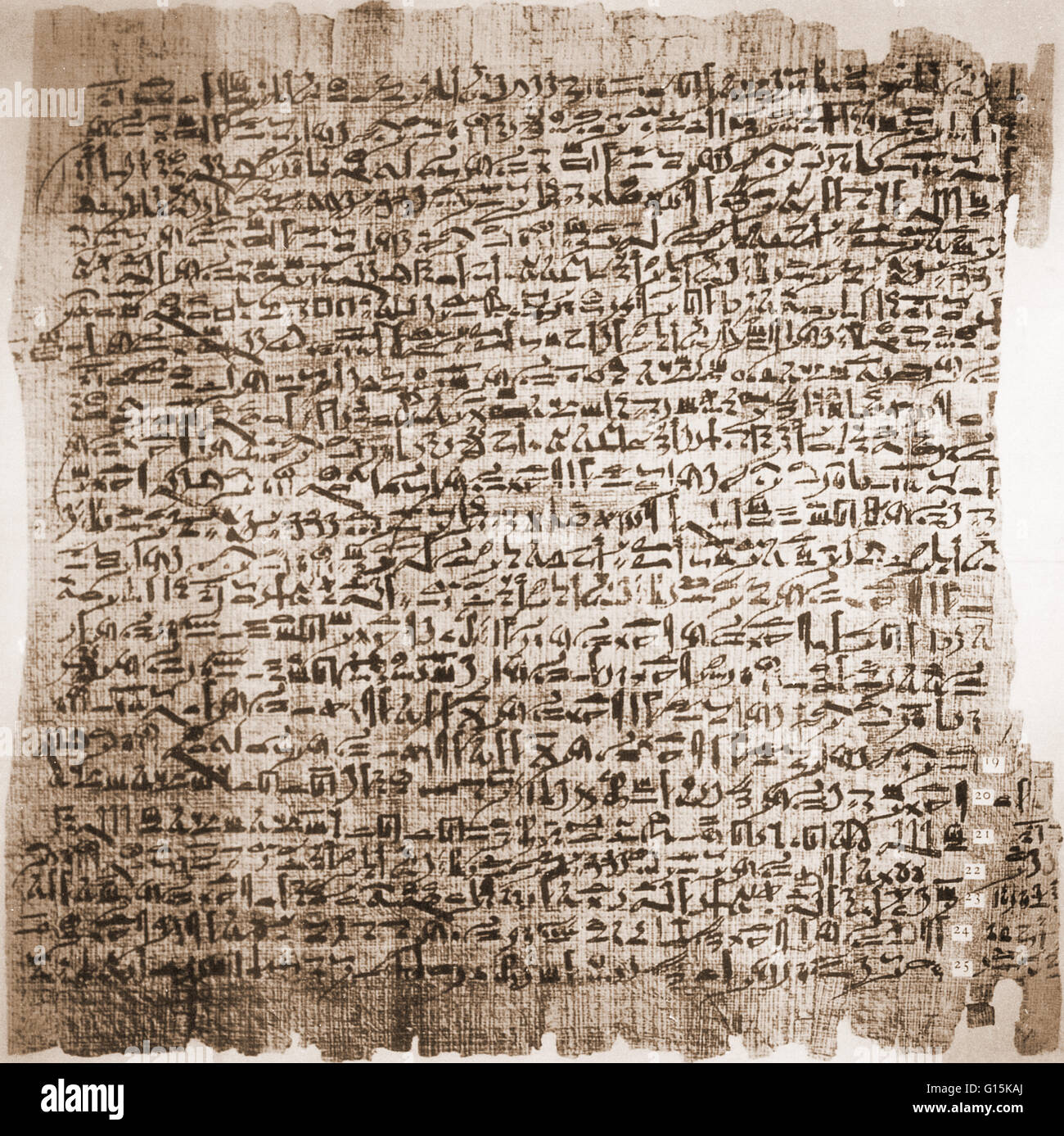 "Fall sechs aus dem Edwin Smith Surgical Papyrus, ca. 1600 v. Chr. Dieses Dokument steht in hieratisch, eine kursive Version des vereinfachten Hierogylphs. Der Fall beschreibt eine klaffende Wunde am Kopf mit zusammengesetzten engagierte Fraktur des Schädels und Bruch des Stockfoto