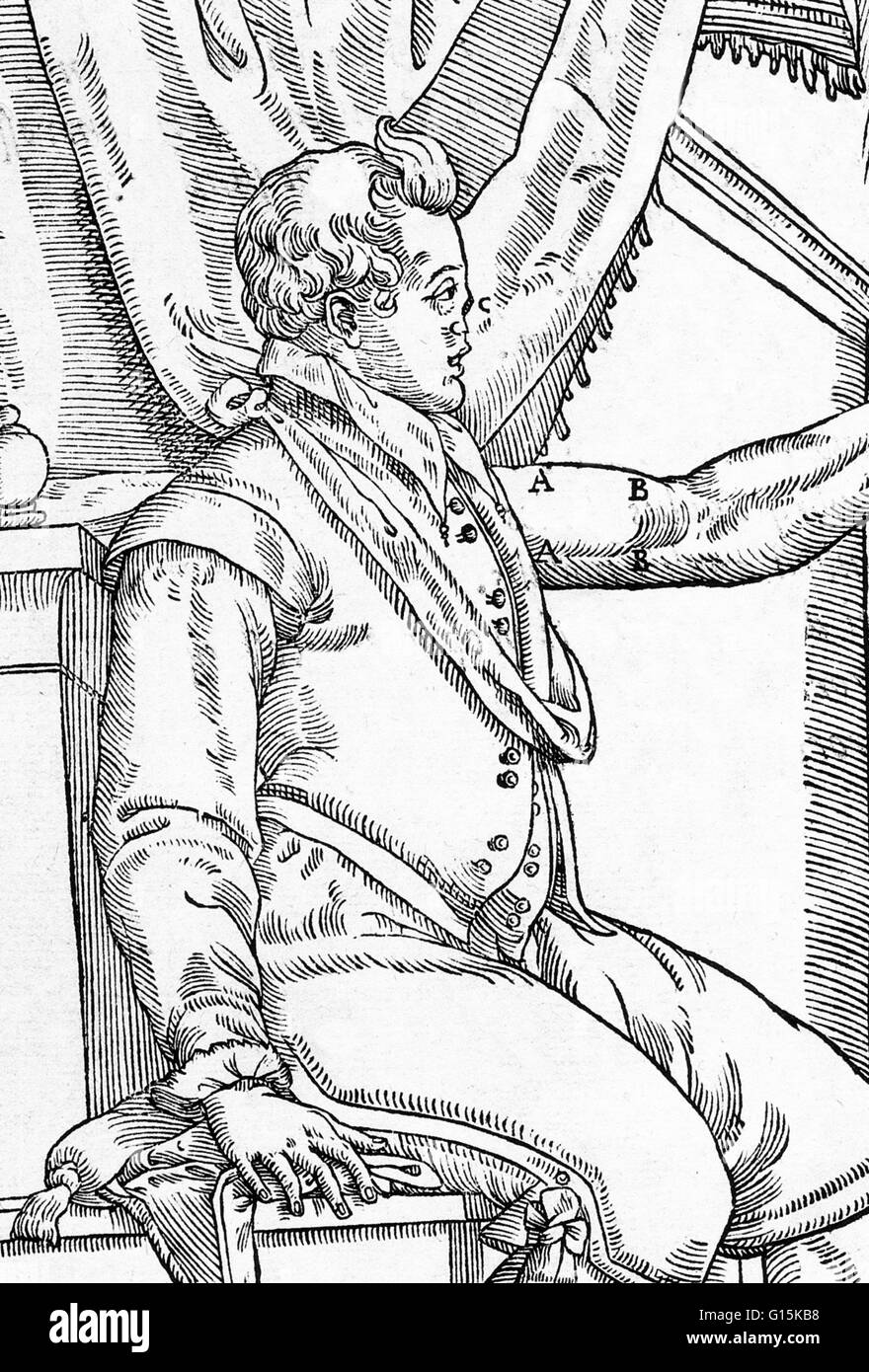 Eine Gaspare Tagliacozzis Methoden für den Ersatz eines fehlenden Nase.  Hier sehen wir die fehlende Nase (C) und die Fläche (A - B) am Oberarm, wo ein Hautlappen geschält entfernt und auf den Nasenbereich verpflanzt werden.  Gaspare Tagliacozzi (1547-1599) war eine Ita Stockfoto