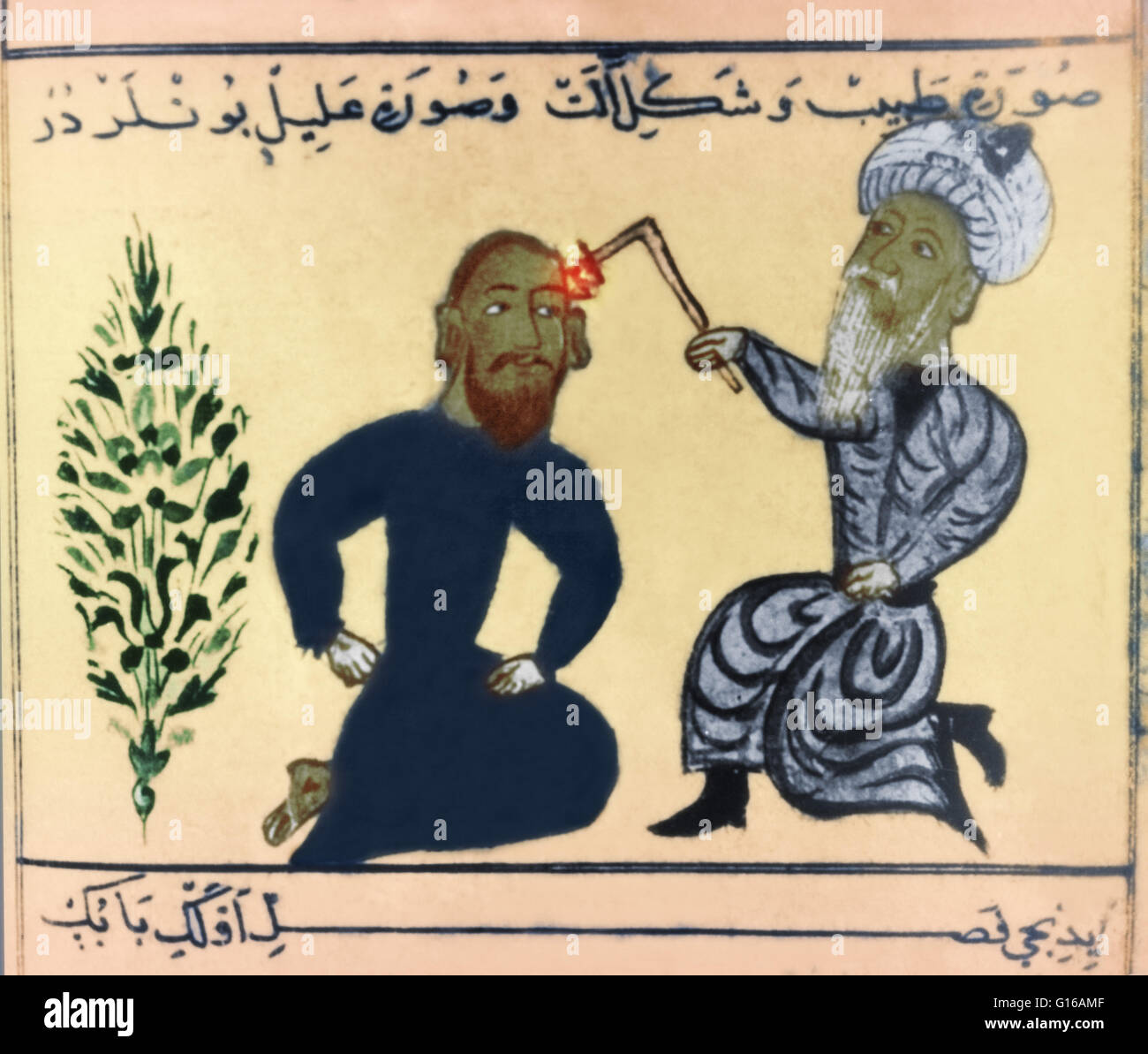 Mittelalterliche Persische Handschrift Seite zeigt einen Arzt, eine Wunde mit einem glühenden Eisen Heilkünsten. Stockfoto