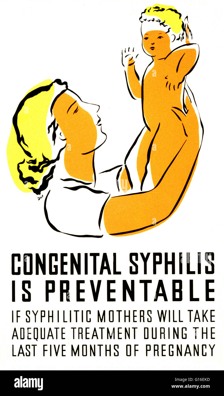 Unter dem Titel: "angeborenen Syphilis ist vermeidbar. Wenn syphilitischen Mütter angemessenen Behandlung in den letzten fünf Monaten der Schwangerschaft dauert ". Plakat für die New York State Department of Health, Förderung angemessene Behandlung für Syphilis für schwangere Frauen, zeigen Stockfoto
