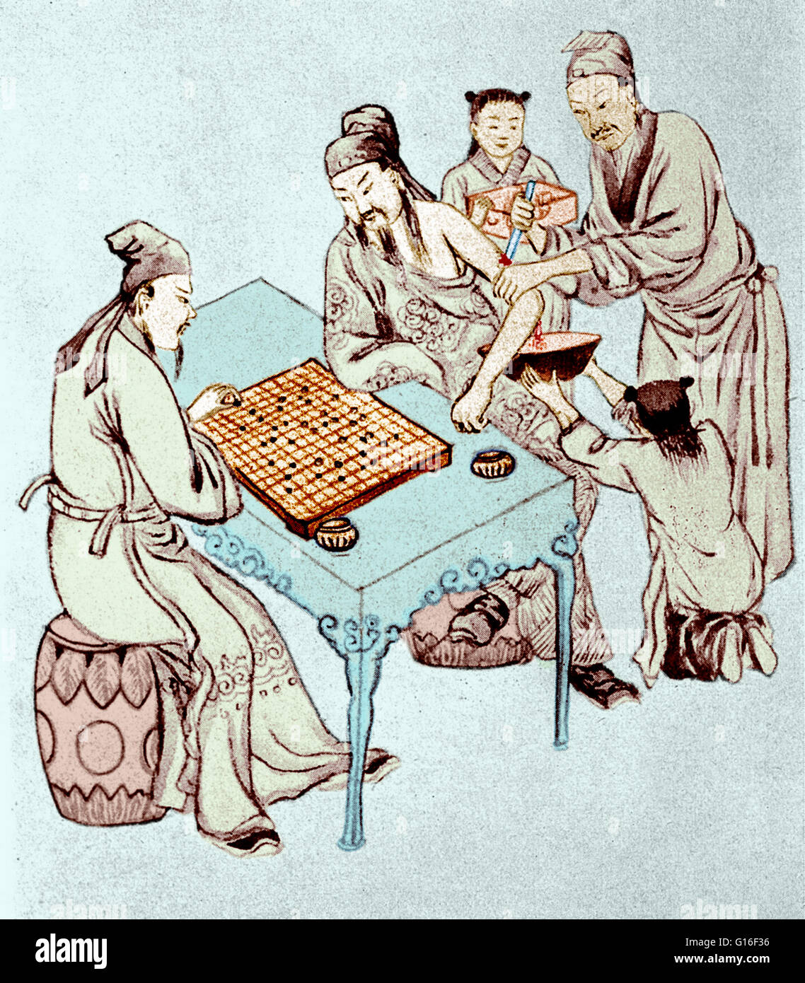 Arzt Hua Tuo auf der Kriegsheld Juan Kung für Nekrose der Arm durch eine Wunde in der Schlacht. Das Go-Spiel wird gespielt wird, um den Patienten Aufmerksamkeit ablenken. Hua Tuo (ca. 140-208) war eine antike chinesische Arzt lebte in der späten Ostern Stockfoto