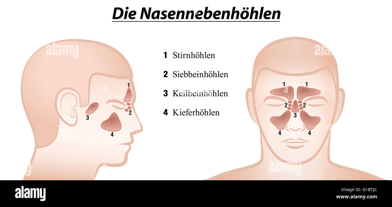 Nasennebenhöhlen Nasennebenhöhlen - vordere und seitliche Ansicht - deutsche Namen! Stockfoto